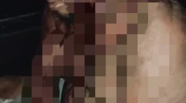Foto: Kondisi Ronal yang merupakan Satpam Perumahan 2100 saat dilarikan ke Rumah Sakit usai dikeroyok pelaku pencurian. 