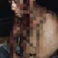 Foto: Kondisi Ronal yang merupakan Satpam Perumahan 2100 saat dilarikan ke Rumah Sakit usai dikeroyok pelaku pencurian. 
